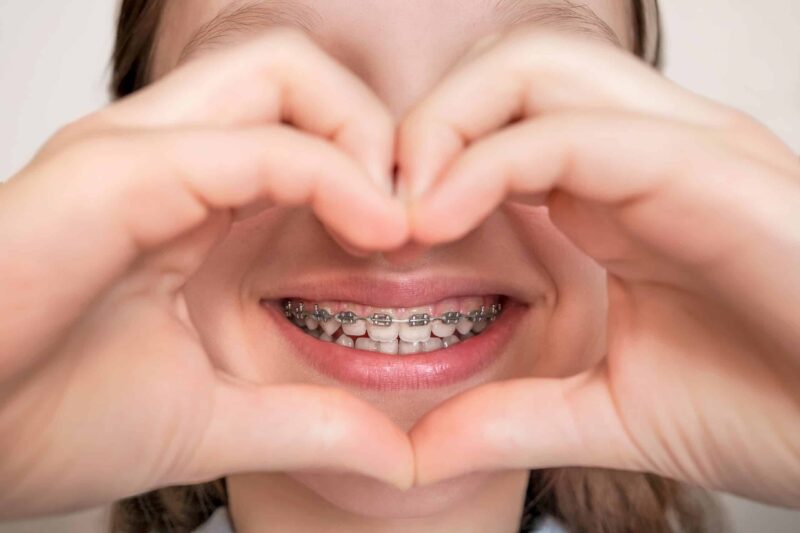Orthodontist in West Jordan